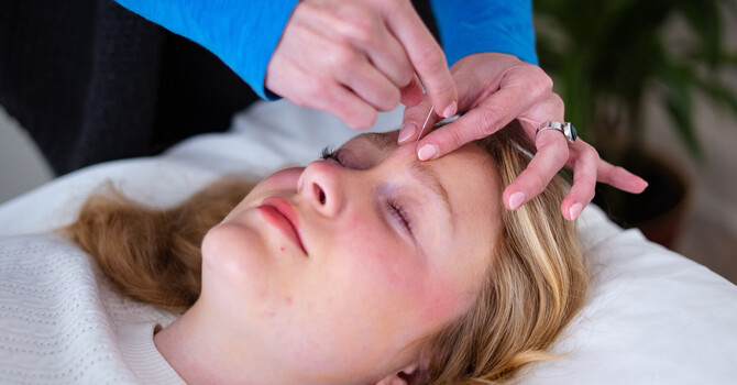 Acupuncture
